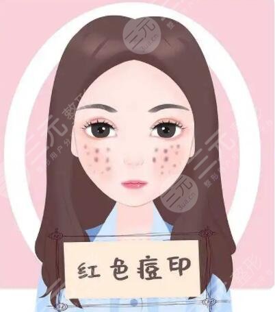 扬州市苏北人民医院整形科成功案例