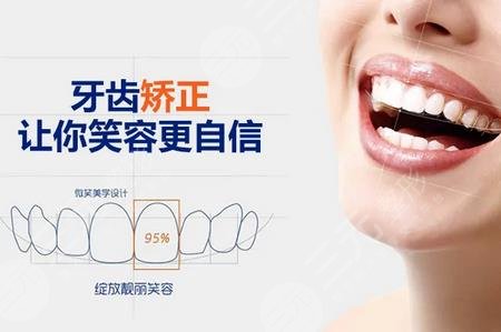 牙齿矫正的好处