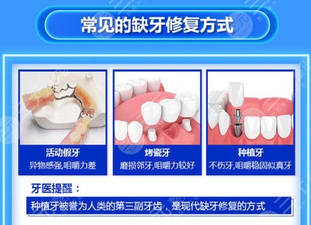 番禺中心医院牙科种植牙案例
