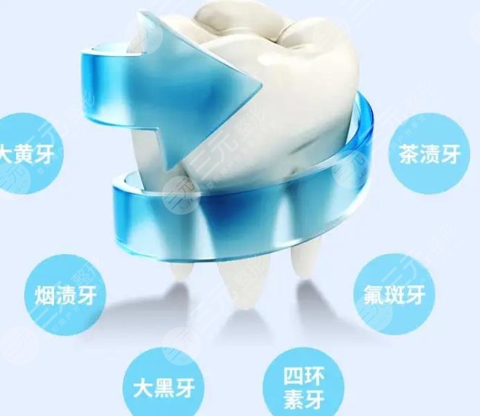 北京中诺口腔医院牙齿美白果图