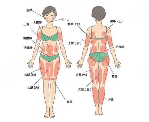 广医二院整形外科腿部吸脂案例