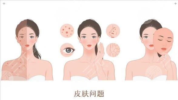 光子嫩肤效果图