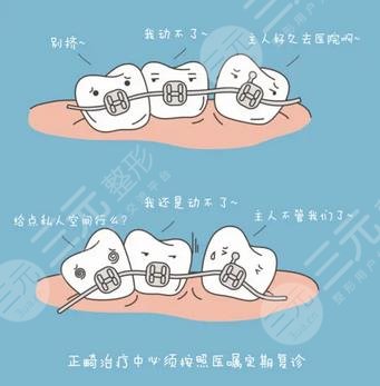 牙齿矫正