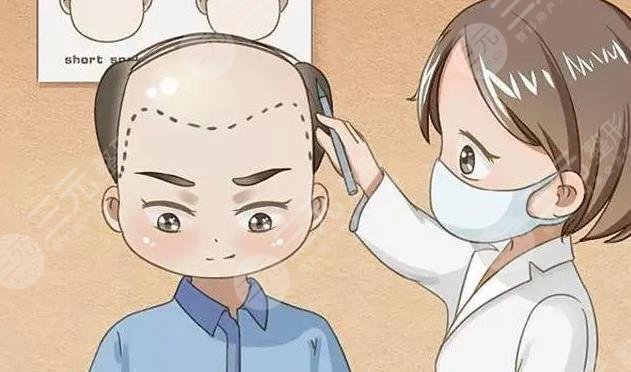 南阳市中心医院植发怎么样