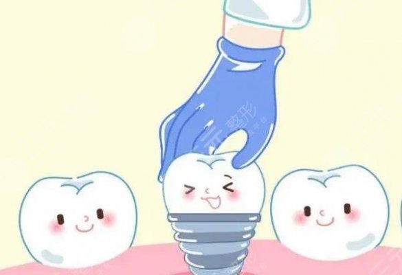 珠海市第二人民医院种植牙价格是怎样的？医生介绍&价格详情 感兴趣来看看