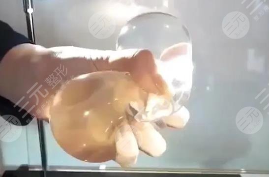 胸部整形