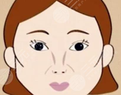 颧骨