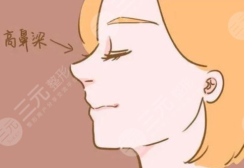 整一个鼻子大概需要多少钱