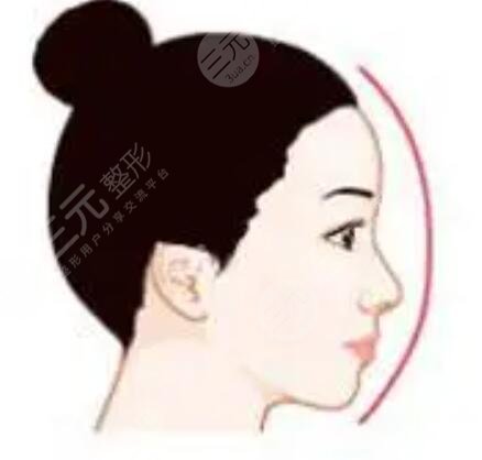 苏大附一院美容手术科隆鼻果图