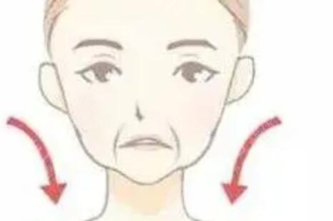广州禾丽医美面部填充后