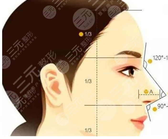 做隆鼻手术恢复图
