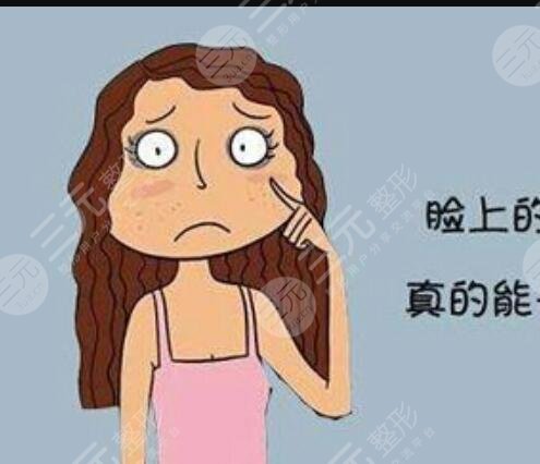 激光设备