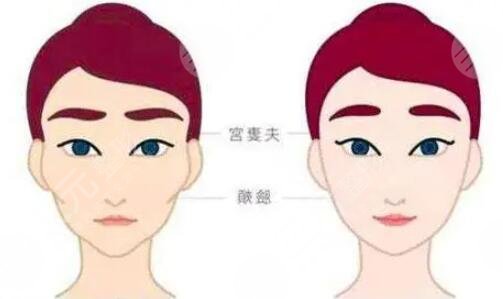 南京中大医院整形美容中心面部填充经历