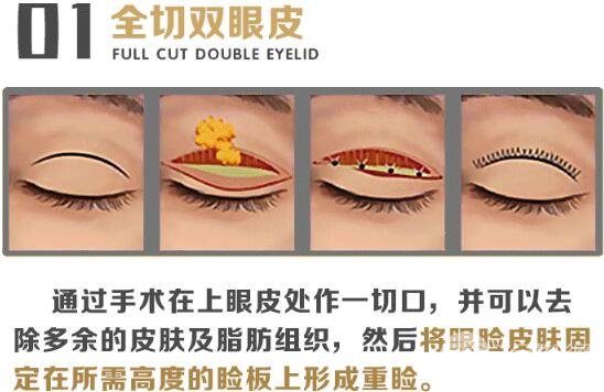甘肃省人民医院整形科割双眼皮怎么样