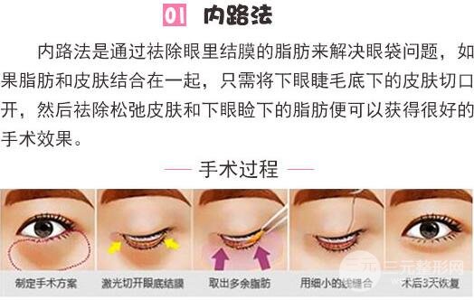 南昌一附医院美容整形科医院去眼袋