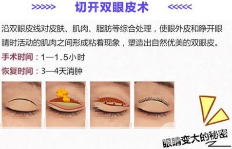 南宁瑞康医院美容整形中心技术好不好