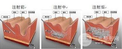 浙医二院美容科皮肤美容怎么样