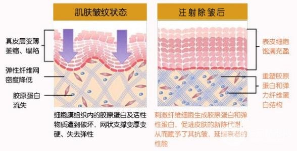 湘雅附一医院激光美容术技术好不好