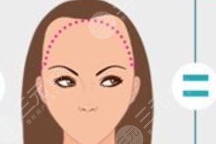 茂名植发公立医院