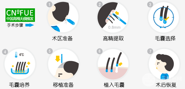 雍禾植发10元和20元的区别