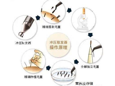 武汉植发公立医院