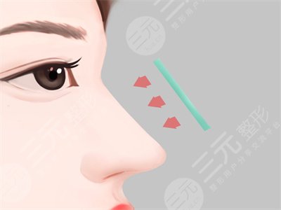 陈朗医生