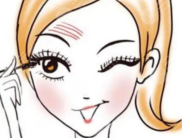 李天石医生双眼皮手术案例介绍