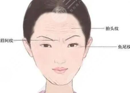 深圳小柯丽格欧洲之星面部紧致案例分享
