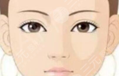 宝鸡人民医院整形美容科双眼皮案例：手术之前
