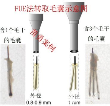 2020年度深圳植发医院排行