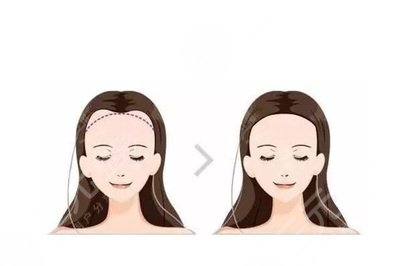 武汉新生植发有几年了