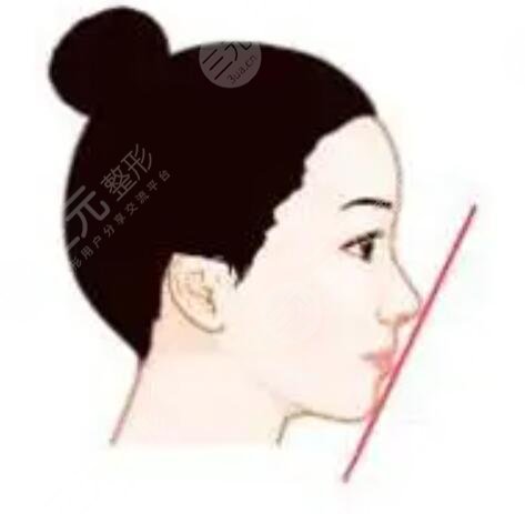 兰大二院整形外科费用，兰大二院隆鼻做得好吗？附案例图  