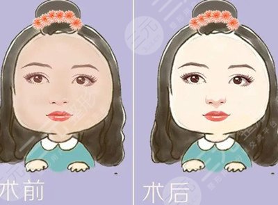 天水407医院热玛吉美容案例