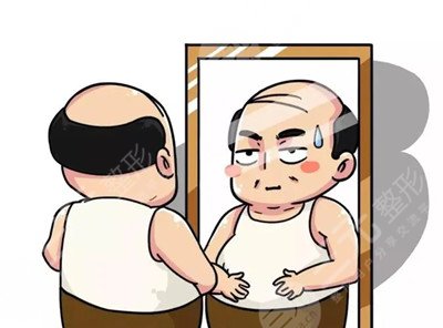 植发案例