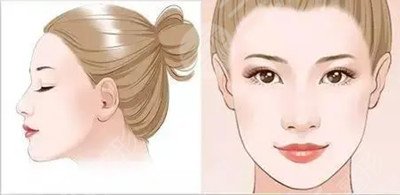 八大处医疗整形医院颧骨内推术前