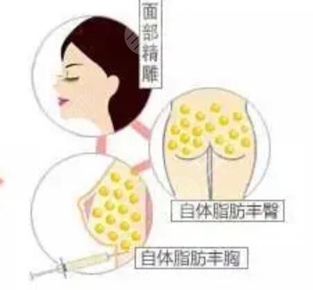 面部填充案例