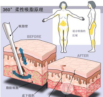 南京熙而美整形医院价格表实用推荐一览