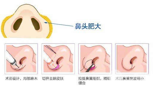 宜春华美整形医院价格表正规推荐一览