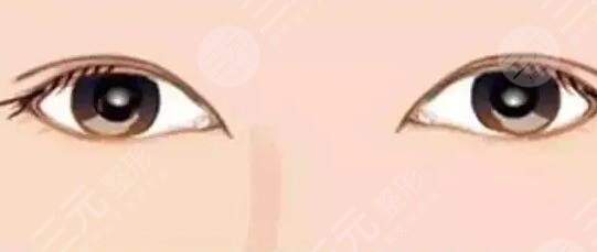 张勇