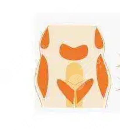 北京清木医疗美容医院脂肪填充案例