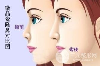 合肥凯婷医疗美容医院完整价目表一览马克