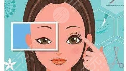 华容高恩医美整形真人双眼皮术前