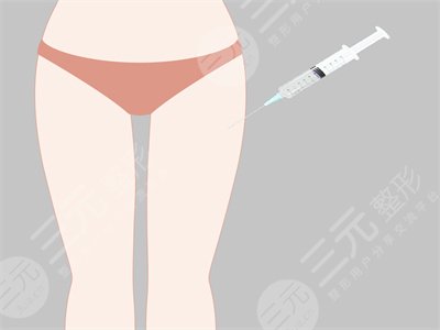 dream梦想整形外科大腿吸脂后