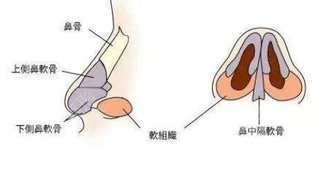 深圳美莱隆鼻手术案例