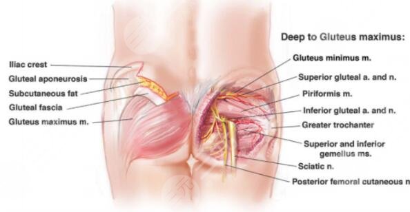 北京华韩做假体臀部手术案例