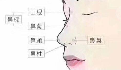 深圳艺星做鼻子真实案例
