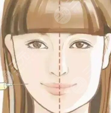 宝鸡人民医院整形美容科割双眼皮,内附真实案例分享