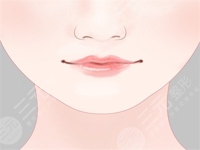 南方医科大学整形科