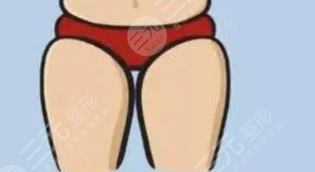台山人民医院整形美容科好不好?医生简介|附吸脂案例
