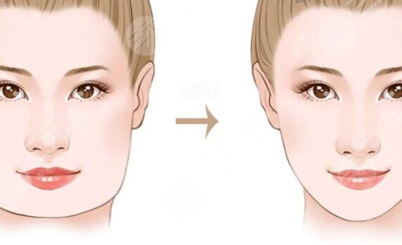 北京圣嘉新医疗美容医院擅长项目介绍